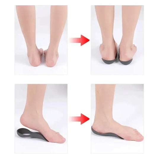 Heel Spur Relief Cushions – Soft Gel Support for Walking Comfort